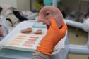 HR produz pelo SUS próteses faciais que recuperam autoestima dos pacientes