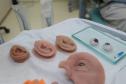 HR produz pelo SUS próteses faciais que recuperam autoestima dos pacientes