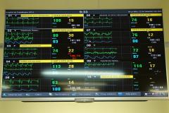 Monitoramento disponível em três telas, instaladas em locais estratégicos