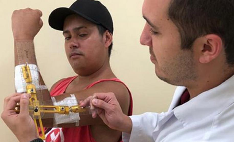 Cirurgia rara de cotovelo devolve movimento a paciente