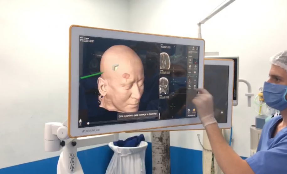 Foi realizada hoje (12), no Complexo do Hospital do Trabalhador, a primeira cirurgia computadorizada utilizando equipamento de última geração adquirido com recursos da Secretaria de Estado da Saúde, repassados do Ministério Público do Trabalho.