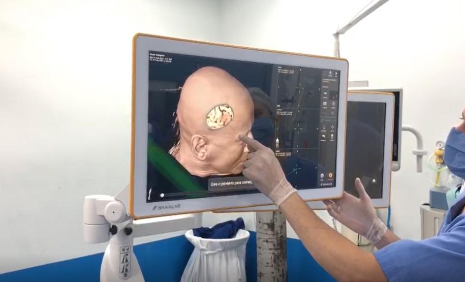 Foi realizada hoje (12), no Complexo do Hospital do Trabalhador, a primeira cirurgia computadorizada utilizando equipamento de última geração adquirido com recursos da Secretaria de Estado da Saúde, repassados do Ministério Público do Trabalho.