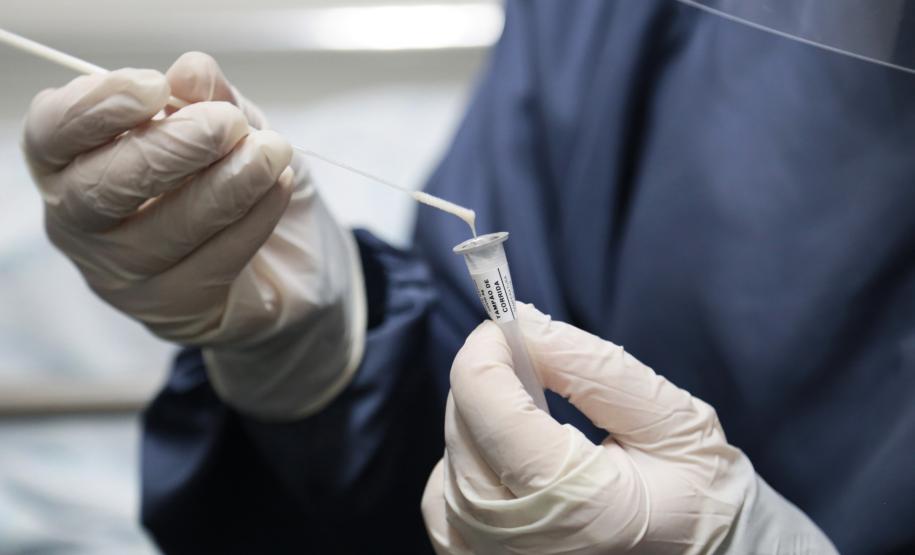 CHT vai incrementar estratégia de testagem Covid-19 em pacientes e colaboradores