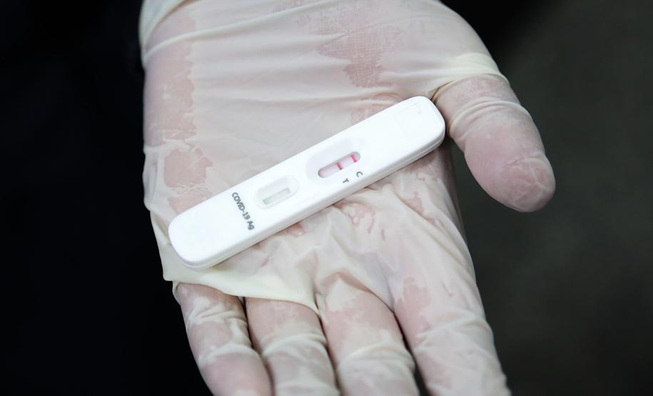 CHT vai incrementar estratégia de testagem Covid-19 em pacientes e colaboradores