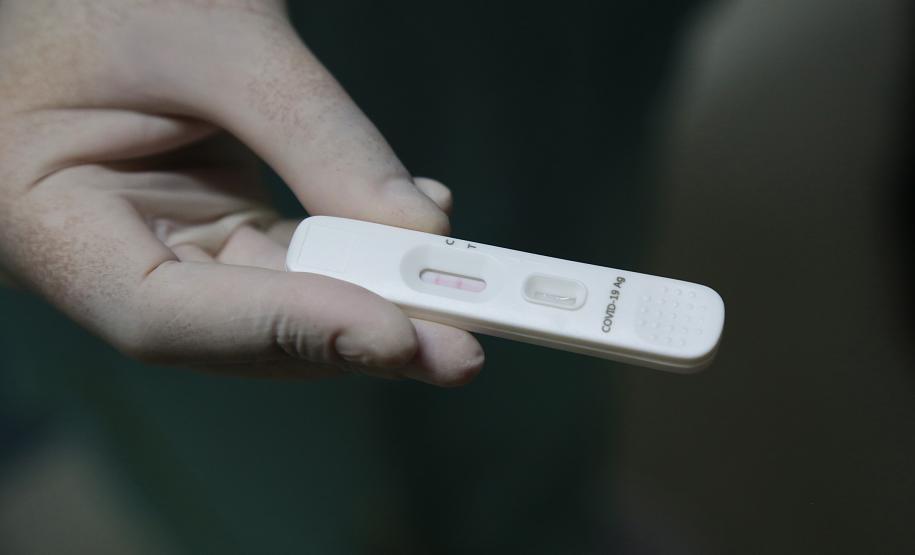 CHT vai incrementar estratégia de testagem Covid-19 em pacientes e colaboradores