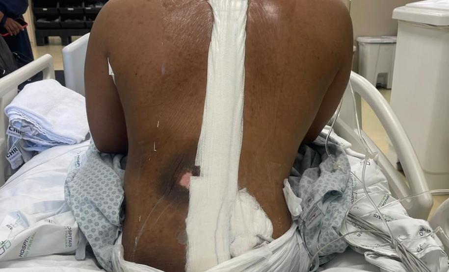 Junho Verde: Saúde alerta sobre importância do tratamento precoce da escoliose