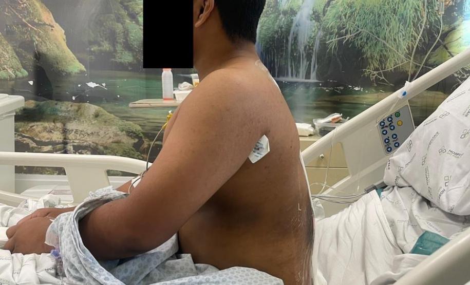 Junho Verde: Saúde alerta sobre importância do tratamento precoce da escoliose