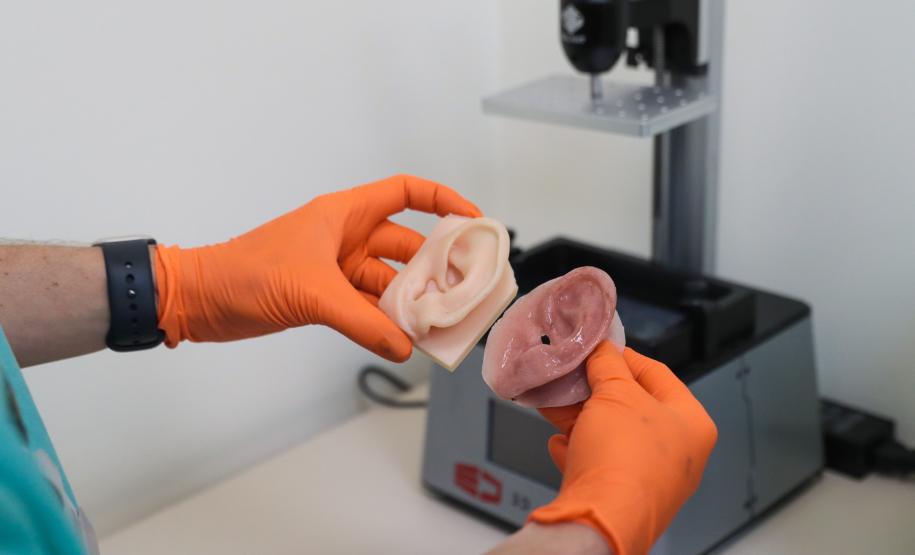 HR produz pelo SUS próteses faciais que recuperam autoestima dos pacientes