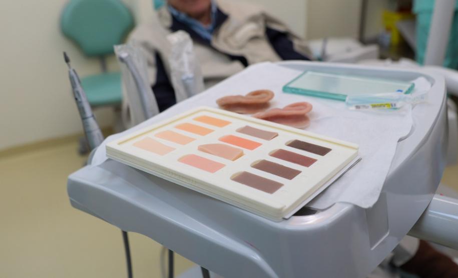 HR produz pelo SUS próteses faciais que recuperam autoestima dos pacientes