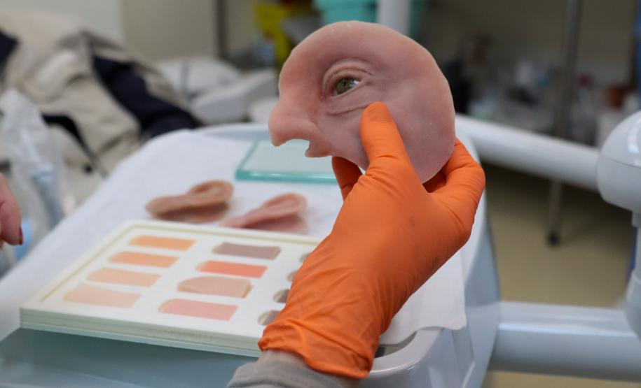 HR produz pelo SUS próteses faciais que recuperam autoestima dos pacientes