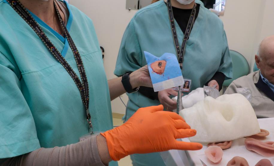 HR produz pelo SUS próteses faciais que recuperam autoestima dos pacientes