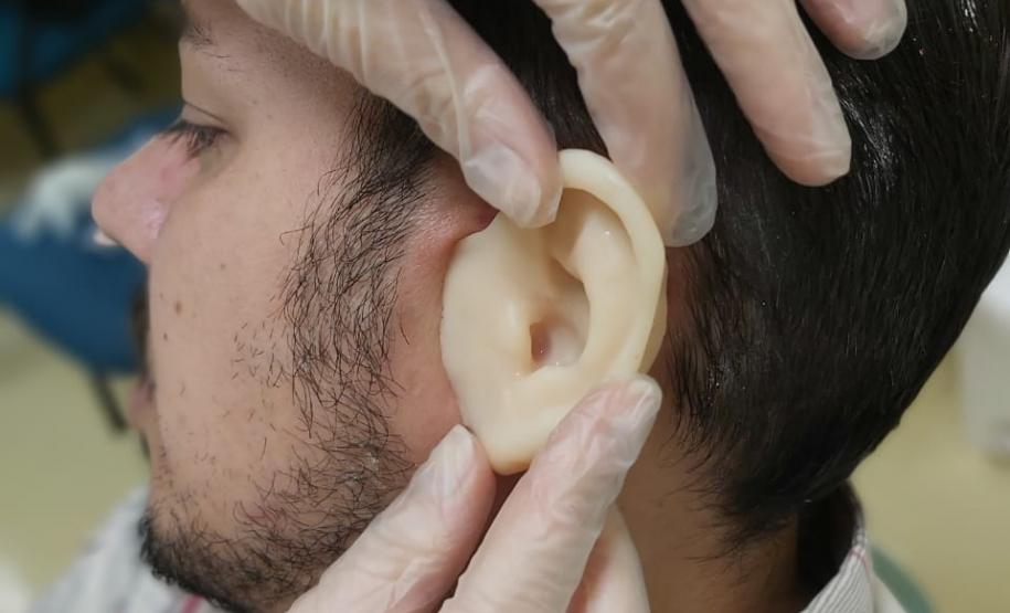 Ambulatório de Próteses Faciais Reconstrutivas inicia atendimentos pelo Sus