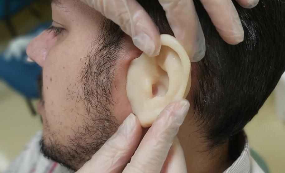 Ambulatório de Próteses Faciais Reconstrutivas inicia atendimentos pelo Sus