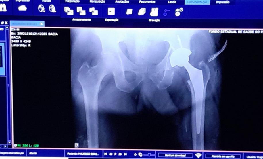 Hospital do Trabalhador realiza cirurgias com transmissão ao vivo